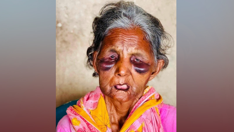 রেলস্টেশনে হামলার শিকার সেই বাকপ্রতিবন্ধী বৃদ্ধা মারা গেছেন 